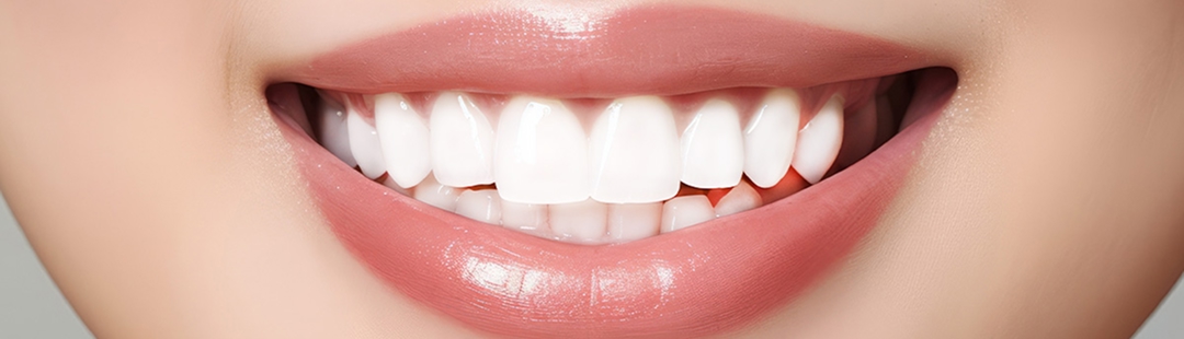 アンカースクリュー矯正のイメージ画像