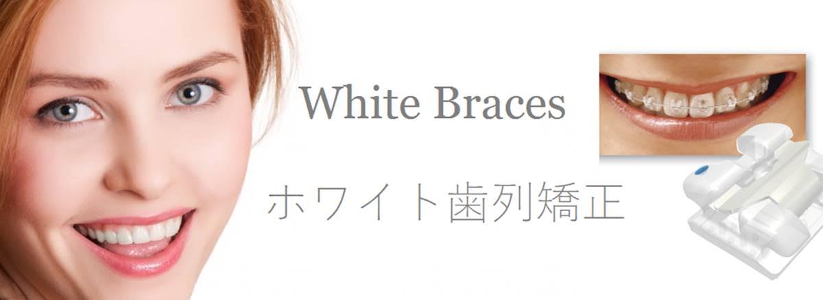 ホワイト歯列矯正